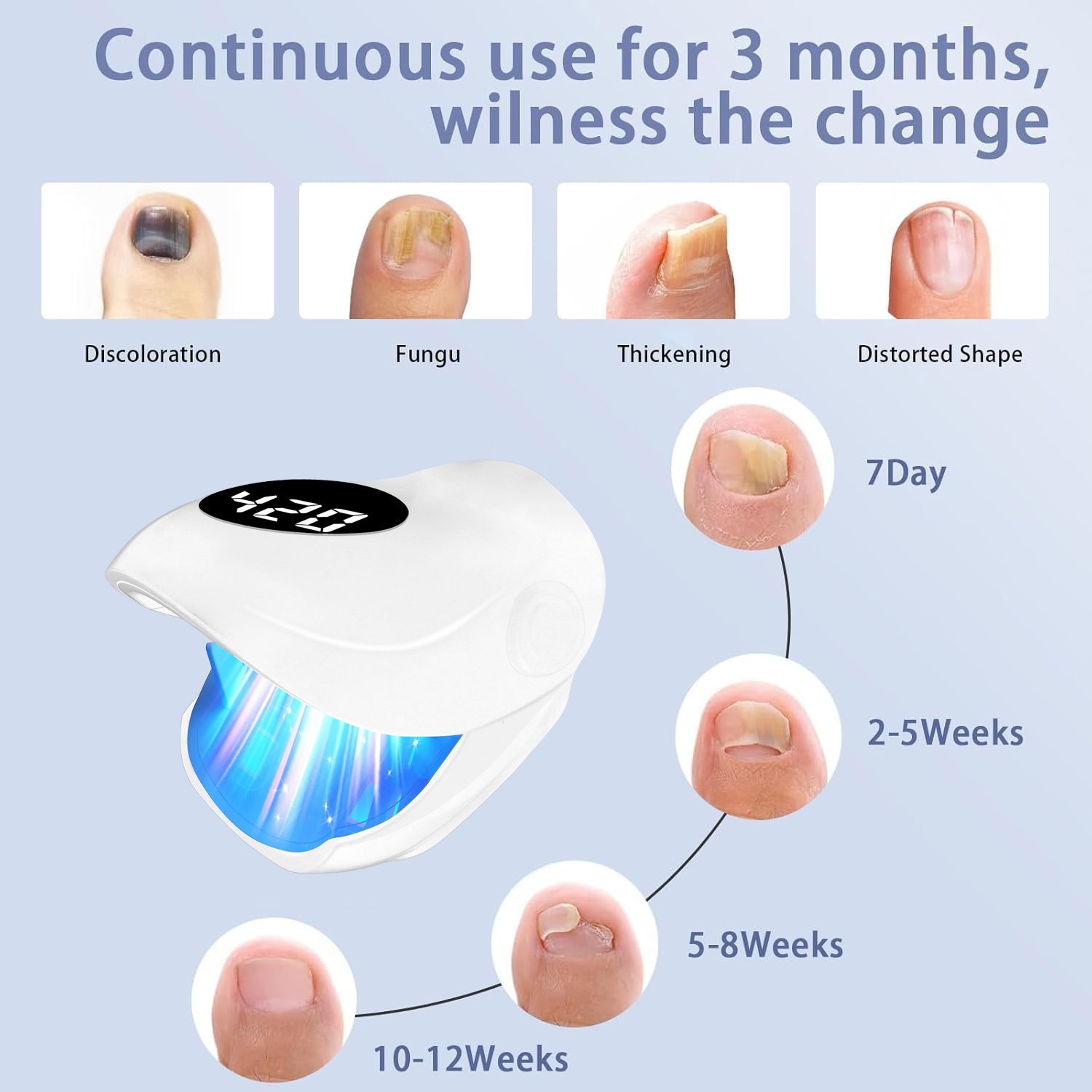 Urządzenie do leczenia grzybic – Galvanic Skin Sensor recenzja i cena